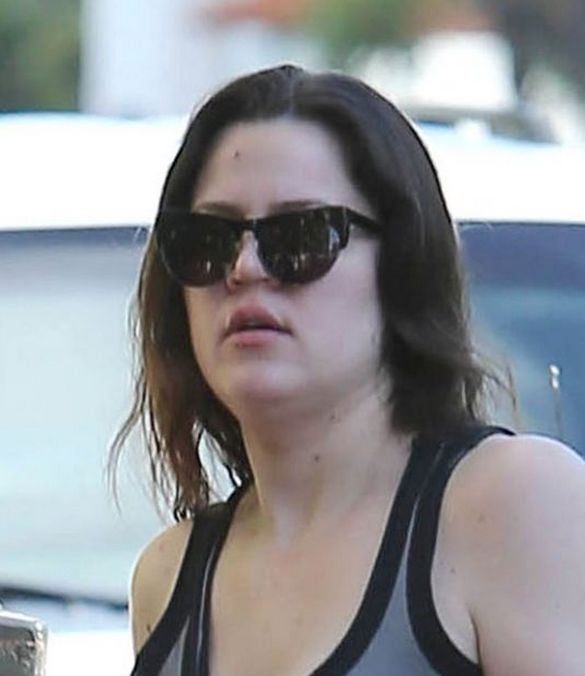 Te gwiazdy borykają się z trądzikiem (FOTO)