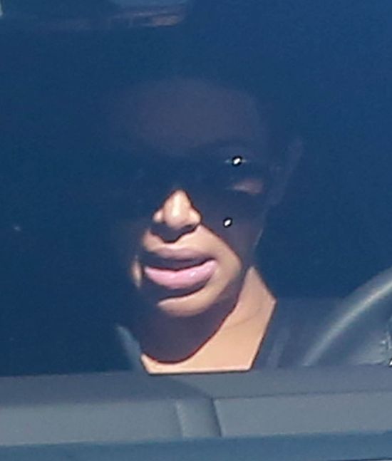 Co się stało z ustami Kim? Powiększyła je w 8 miesiącu ciąży