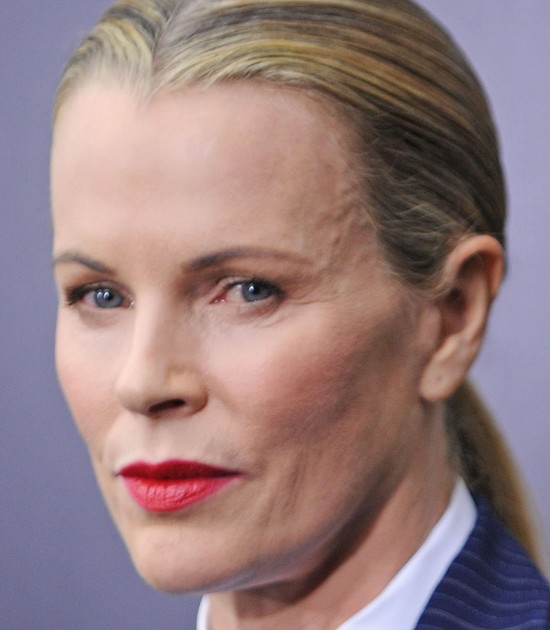 Coś niedobrego dzieje się z twarzą Kim Basinger (FOTO)
