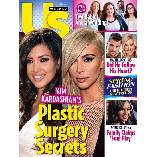 US Weekly: Kim Kardashian ma twarz pełną WYPEŁNIACZY!