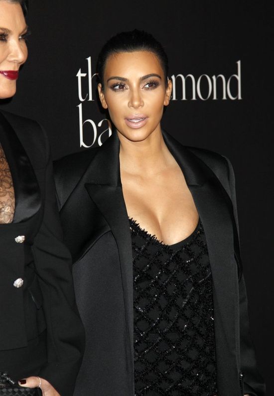 Chcecie zobaczyć Kim Kardashian z aparatem na zębach?