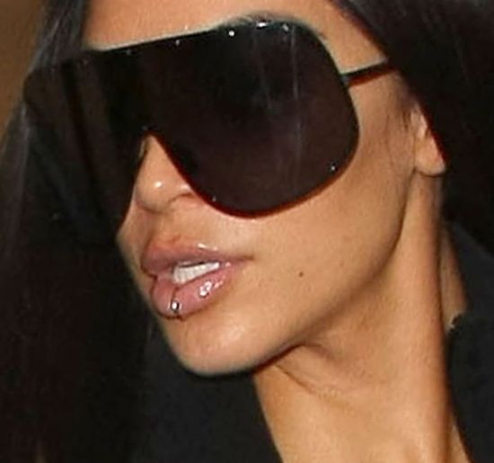 Kim Kardashian wyszła z domu. Widać łuszczycę na jej twarzy? (FOTO)