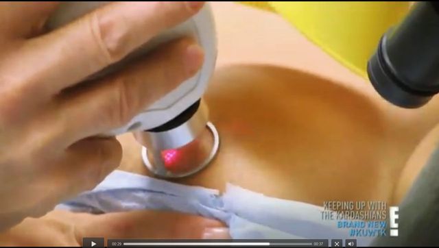 Co Kim Kardashian robiła z piersiami po porodzie? (VIDEO)