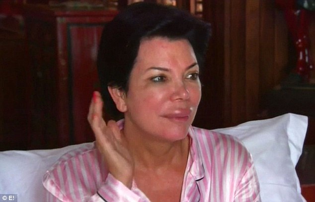 Co się stało z ustami Kris Jenner? (FOTO)