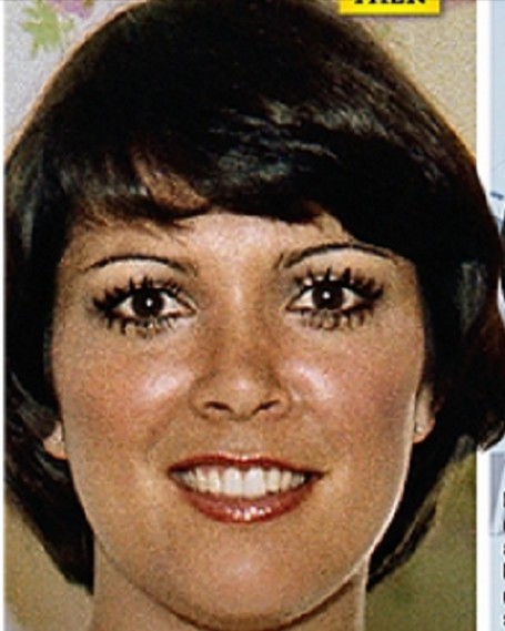 Tak wyglądała Kris Jenner przed operacjami plastycznymi: Tak wyglądała Kris Jenner przed operacjami plastycznymi: