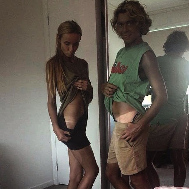 Kurt Coleman - cierpi na tanoreksję, jest gwiazdą Instagrama