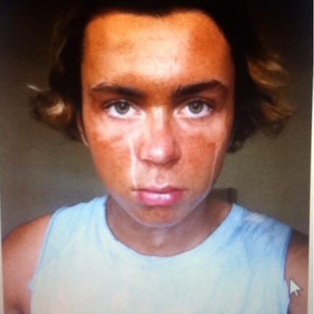 Kurt Coleman - cierpi na tanoreksję, jest gwiazdą Instagrama