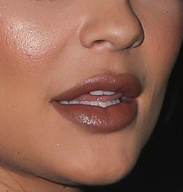 Nie próbujcie tego robić w domu - twarz Kylie Jenner pod lupą (FOTO)