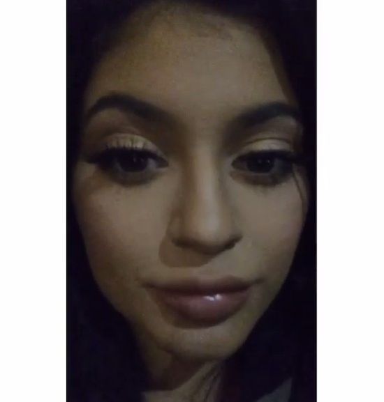 Tak spuchniętych ust Kylie Jenner jeszcze nie miała (FOTO) Tak spuchniętych ust Kylie Jenner jeszcze nie miała (FOTO)