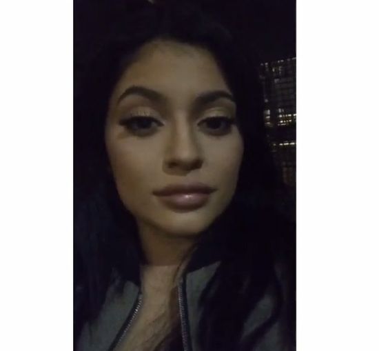 Tak spuchniętych ust Kylie Jenner jeszcze nie miała (FOTO) Tak spuchniętych ust Kylie Jenner jeszcze nie miała (FOTO)