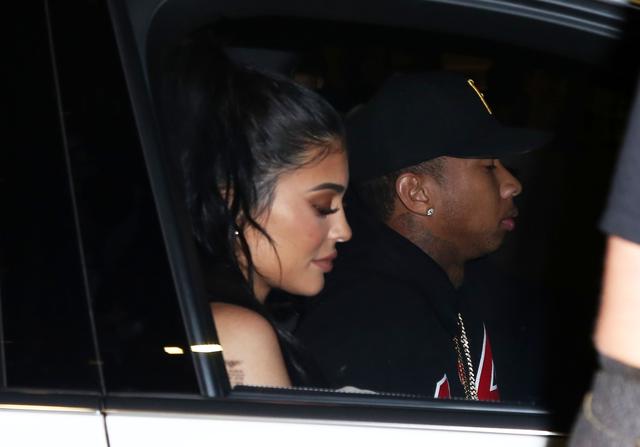 Nie próbujcie tego robić w domu - twarz Kylie Jenner pod lupą (FOTO)