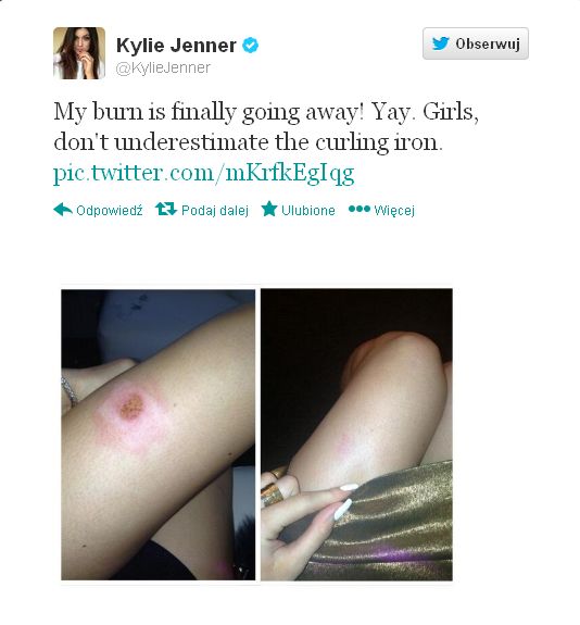 Kylie Jenner cierpi dla piękna (FOTO)