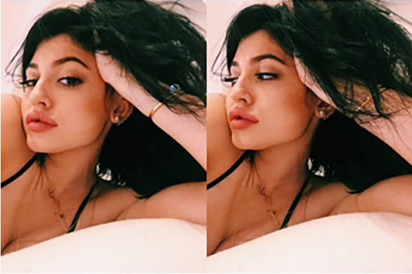 Kylie Jenner już przesadziła z powiększaniem ust? (FOTO)
