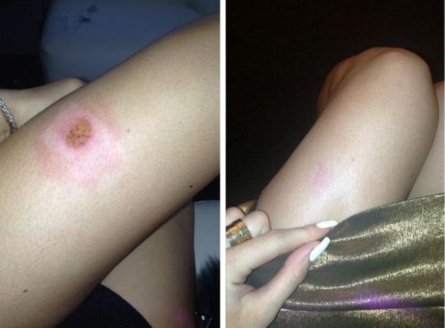 Kylie Jenner cierpi dla piękna (FOTO) Kylie Jenner cierpi dla piękna (FOTO)