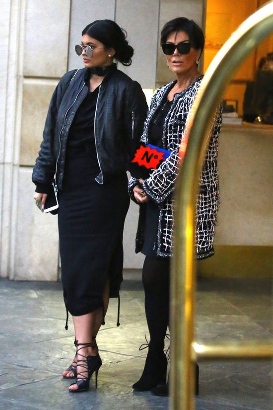 I co z tego, że Kylie Jenner ma ten defekt? (FOTO)