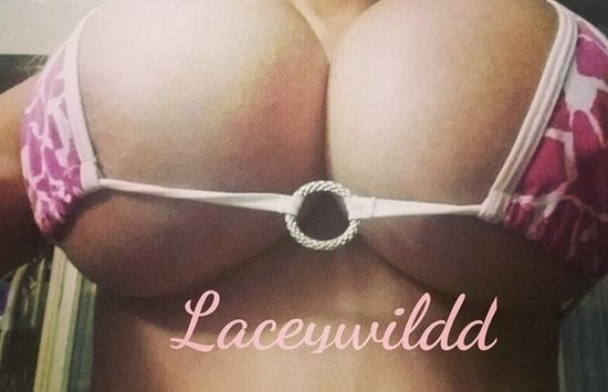 Jej piersi ważą 20 kg, a to tylko początek operacji!