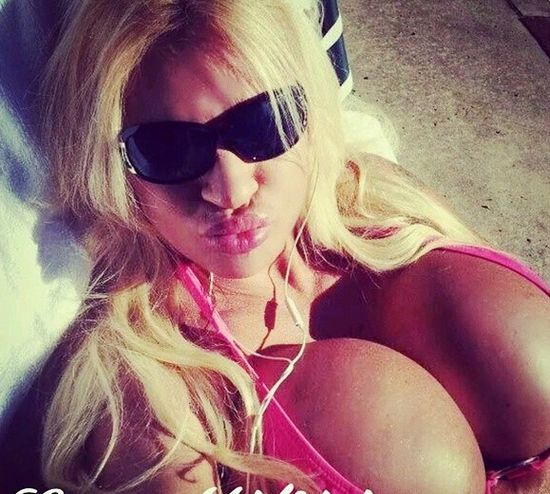 Jej piersi ważą 20 kg, a to tylko początek operacji!