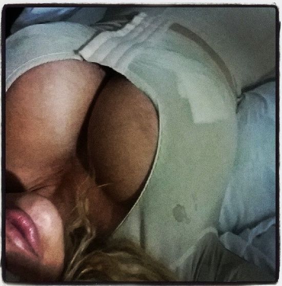 Jej piersi ważą 20 kg, a to tylko początek operacji!