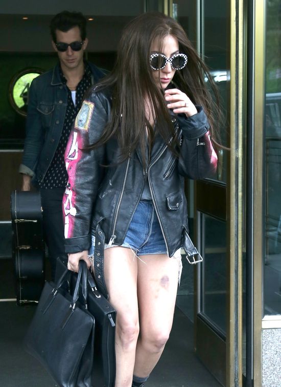 OMG! Co stało się z jej nogami? (FOTO)