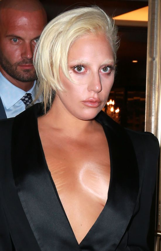 Ona nie wstydzi się swoich rozstępów (FOTO)