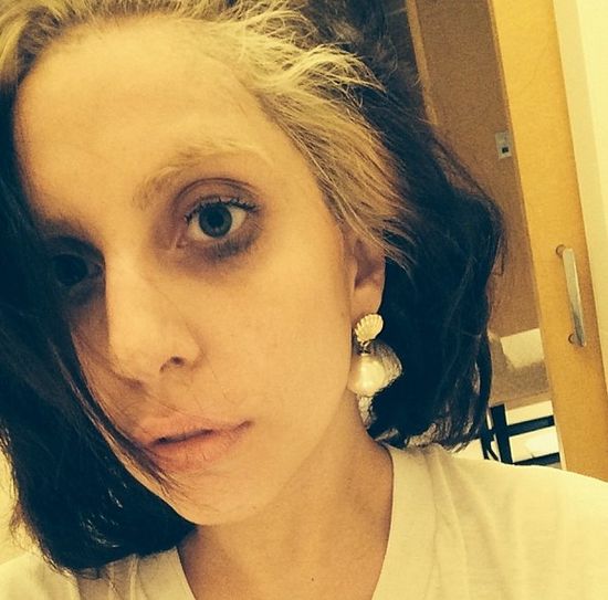 Kontrowersyjny sposób na piękno Lady Gagi