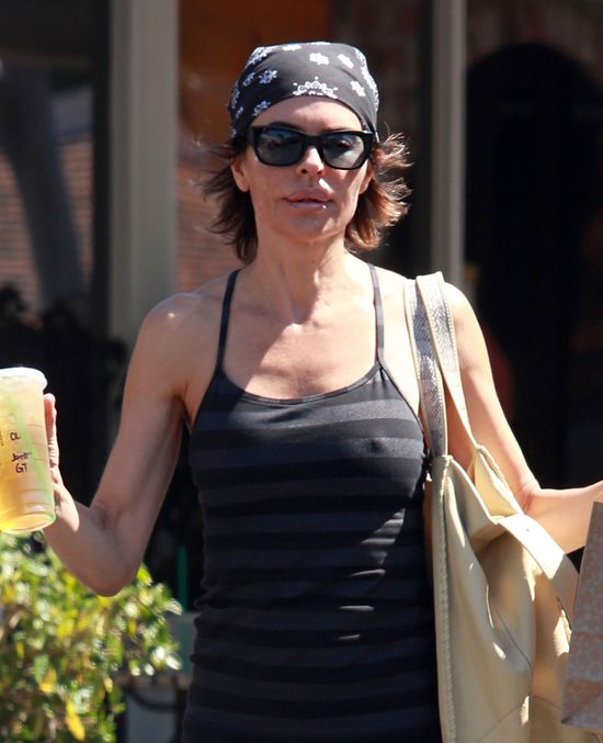 Tak starzeje się królowa operacji plastycznych (FOTO)