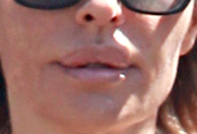 Tak starzeje się królowa operacji plastycznych (FOTO)