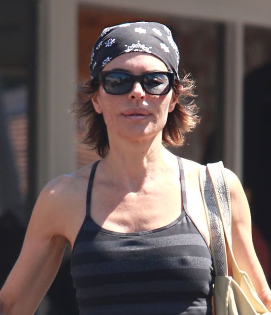 Tak starzeje się królowa operacji plastycznych (FOTO)