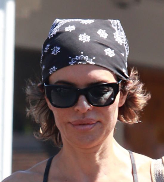 Tak starzeje się królowa operacji plastycznych (FOTO)