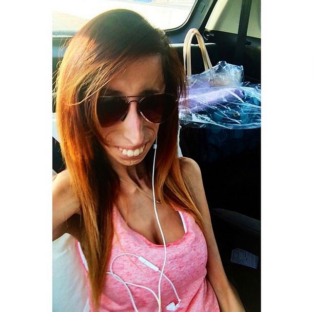 Lizzie Velasquez zwana najbrzudszką kobietą świata... (FOTO)