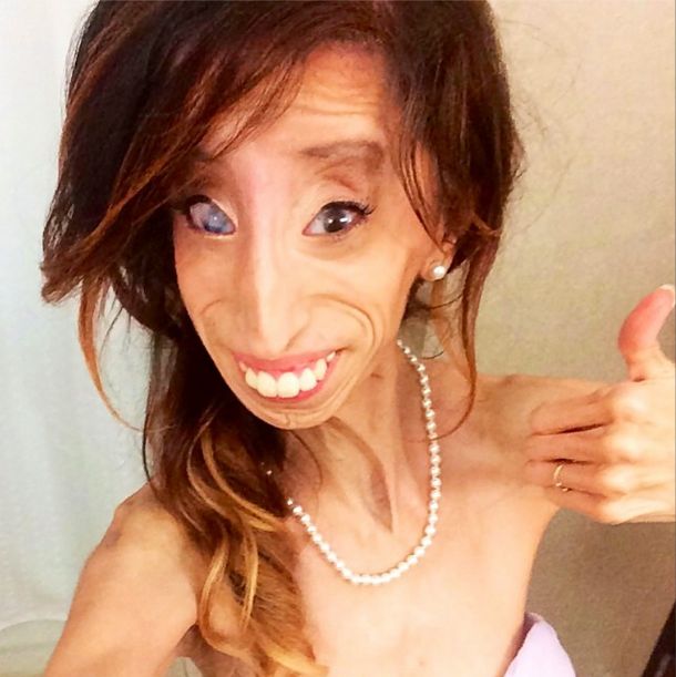 Lizzie Velasquez zwana najbrzudszką kobietą świata... (FOTO)
