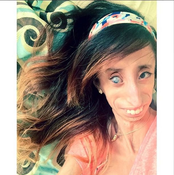 Lizzie Velasquez zwana najbrzudszką kobietą świata... (FOTO)