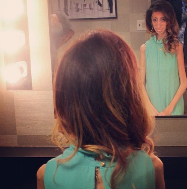 Lizzie Velasquez zwana najbrzudszką kobietą świata... (FOTO)