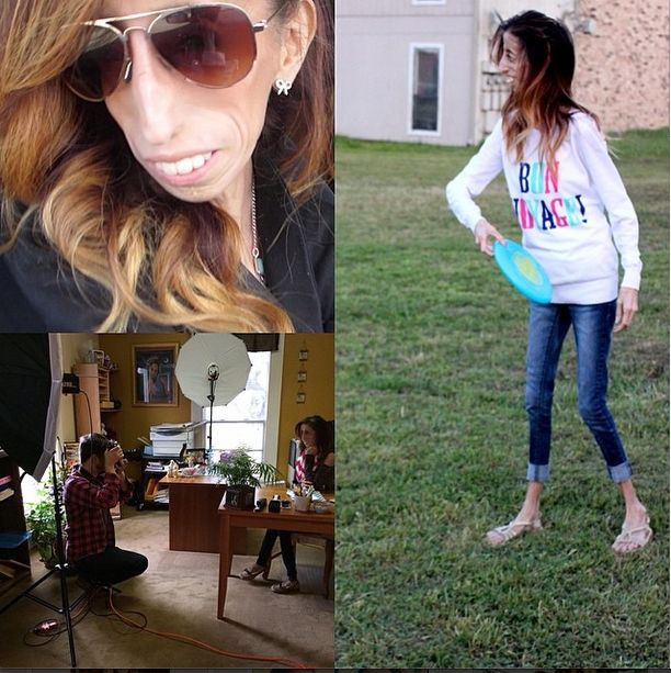 Lizzie Velasquez zwana najbrzudszką kobietą świata... (FOTO)