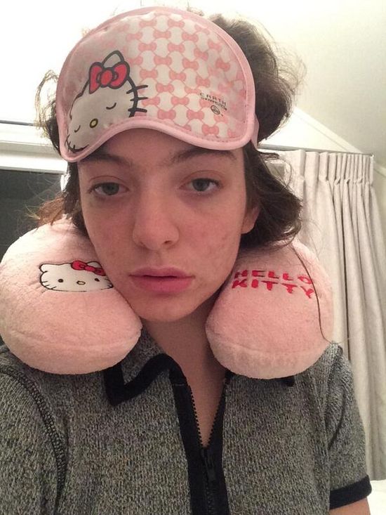 Zaspana Lorde bez makijażu i z trądzikiem (FOTO)