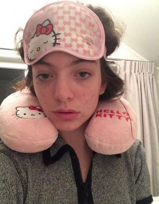 Te gwiazdy borykają się z trądzikiem (FOTO)