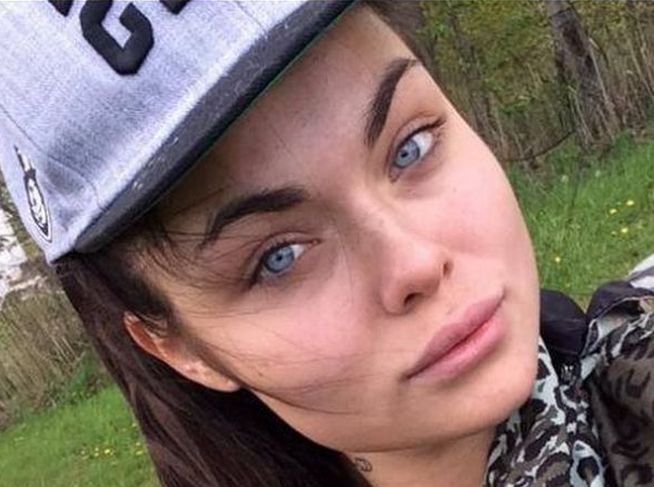 Te gwiazdy borykają się z trądzikiem (FOTO)