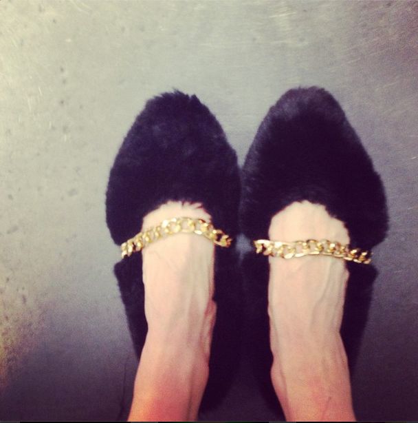 Jej ręce i stopy to same żyły! (FOTO)