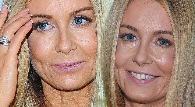 Fanki na Instagramie Małgorzaty Rozenek: Co ty z buzią zrobiłaś? Tragedia!