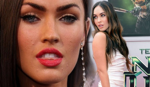 Te gwiazdy borykają się z trądzikiem (FOTO)