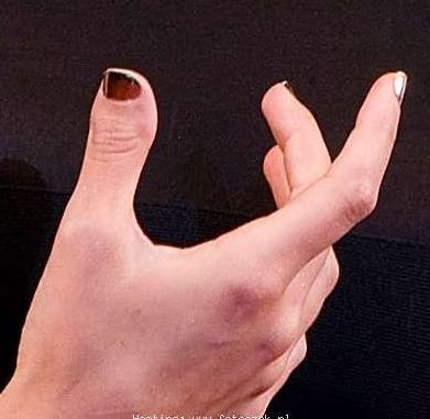 Gwiazdy też mają swoje defekty (FOTO)