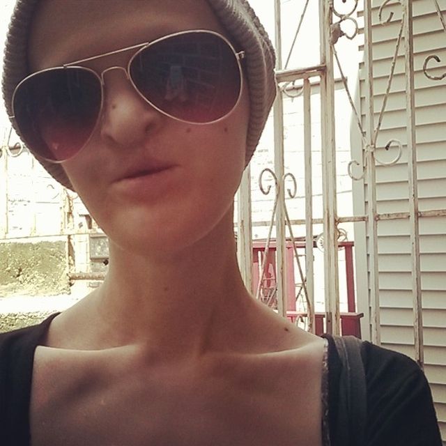 Melanie Gaydos - modelka high fashion z chorobą genetyczną