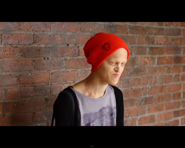 Melanie Gaydos - modelka high fashion z chorobą genetyczną