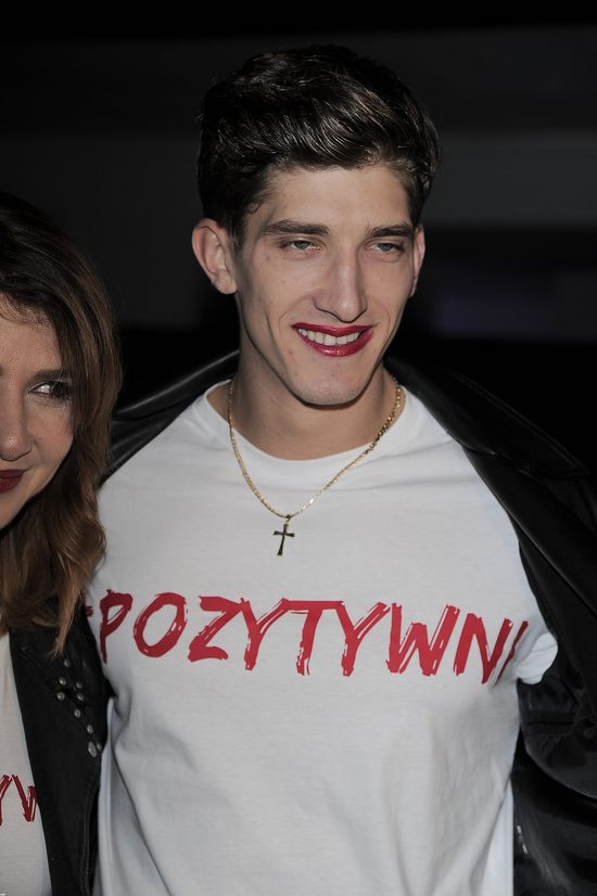 OMG! Co ma na twarzy Michał Baryza? (FOTO)