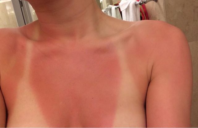 Kto pochwalił się opalenizną? (FOTO) Kto pochwalił się opalenizną? (FOTO)