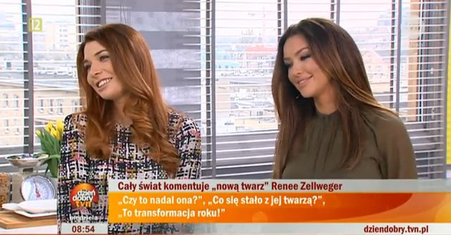 Monika Pietrasińska opowiada o operacjach plastycznych