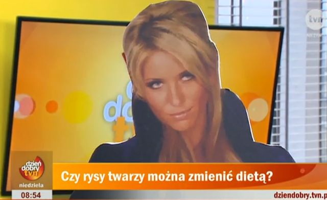 Monika Pietrasińska opowiada o operacjach plastycznych