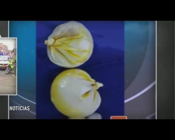 Najdroższe piersi świata? [VIDEO]