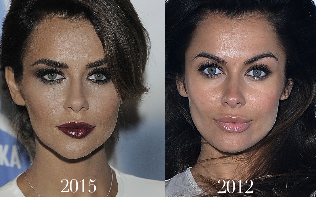 Broda Natalii Siwiec wygląda… dziwnie (FOTO)