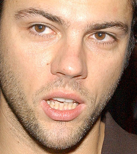 Olivier Janiak: Mam zrobione zęby, bo naturalne były okropne